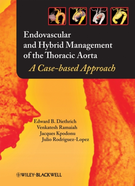 Endovascular and Hybrid Management of the Thoracic Aorta : A Case-based Approach, EPUB eBook