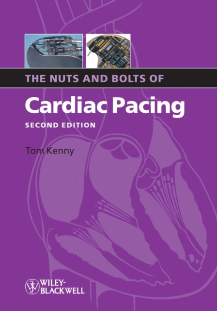The Nuts and Bolts of Cardiac Pacing, EPUB eBook