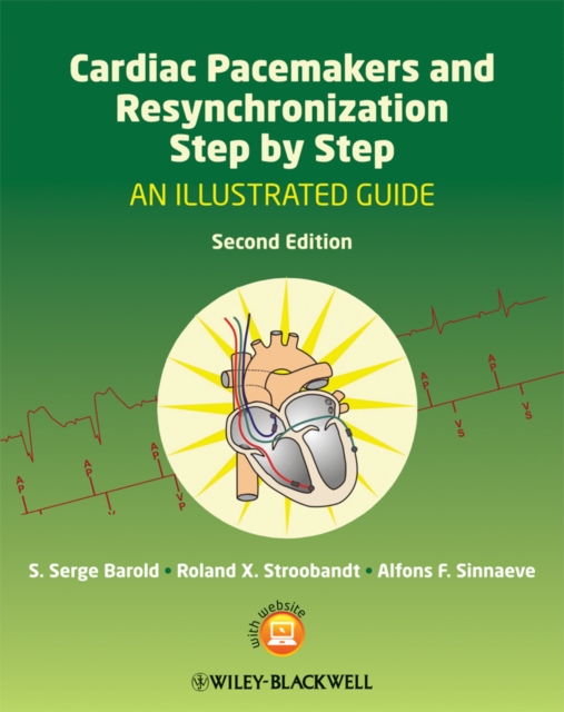 Cardiac Pacemakers and Resynchronization Step by Step : An Illustrated Guide, EPUB eBook