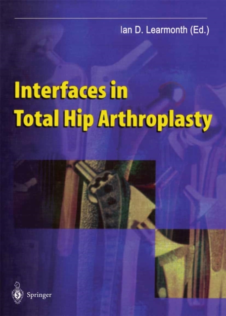Interfaces in Total Hip Arthroplasty, PDF eBook