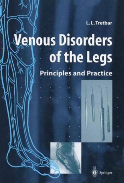 Venous Disorders of the Legs : Principles and Practice, Paperback / softback Book