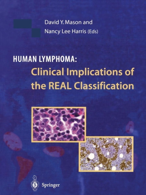 Human Lymphoma: Clinical Implications of the REAL Classification, Paperback / softback Book