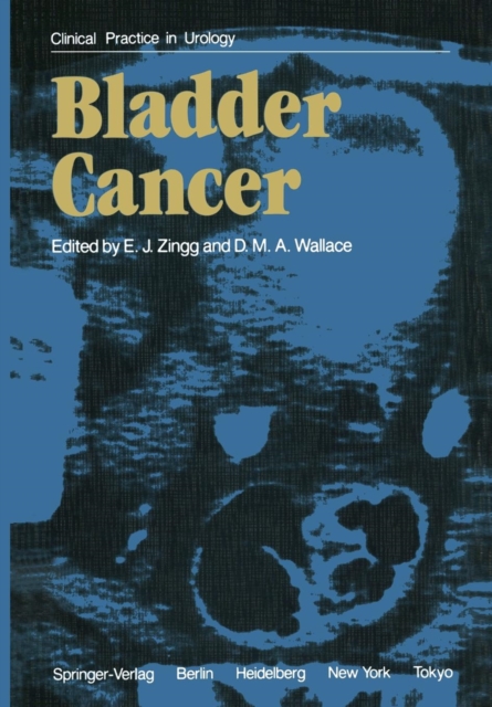 Bladder Cancer, Paperback / softback Book