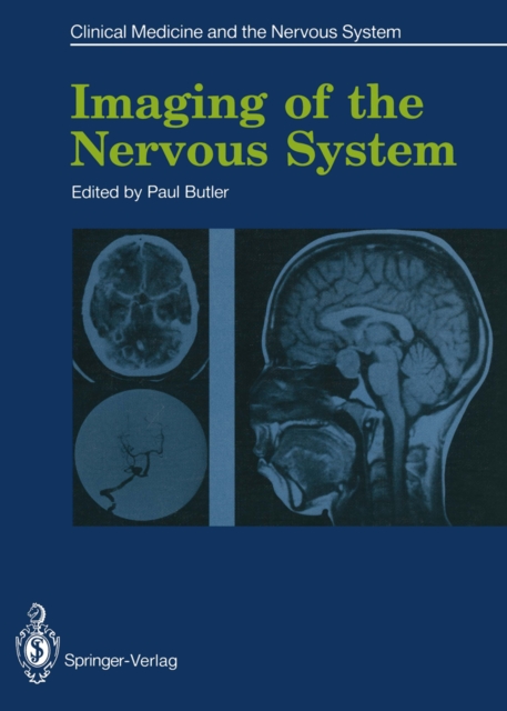 Imaging of the Nervous System, PDF eBook