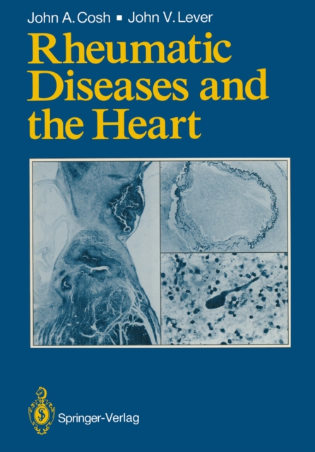 Rheumatic Diseases and the Heart, PDF eBook