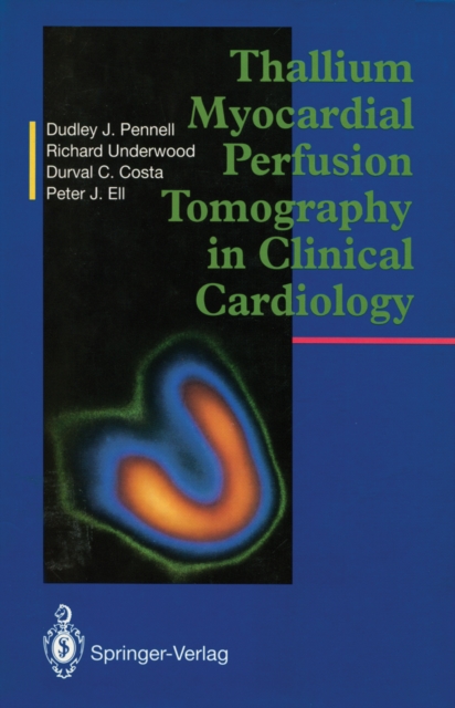 Thallium Myocardial Perfusion Tomography in Clinical Cardiology, PDF eBook
