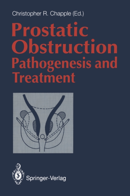 Prostatic Obstruction : Pathogenesis and Treatment, PDF eBook