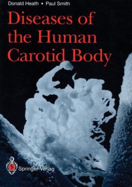 Diseases of the Human Carotid Body, Paperback / softback Book