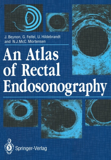 An Atlas of Rectal Endosonography, Paperback / softback Book
