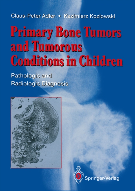 Primary Bone Tumors and Tumorous Conditions in Children : Pathologic and Radiologic Diagnosis, PDF eBook