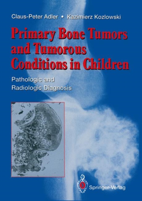 Primary Bone Tumors and Tumorous Conditions in Children : Pathologic and Radiologic Diagnosis, Paperback / softback Book