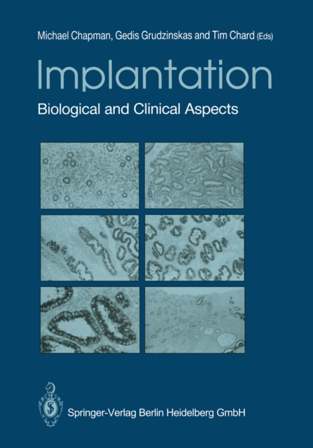 Implantation : Biological and Clinical Aspects, PDF eBook