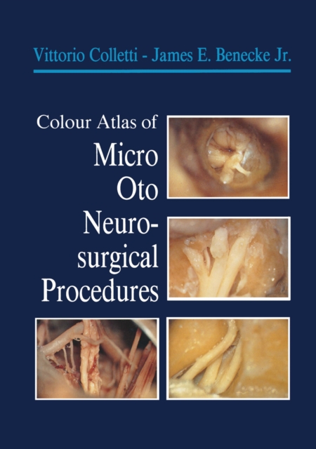 Colour Atlas of Micro-Oto-Neurosurgical Procedures, PDF eBook