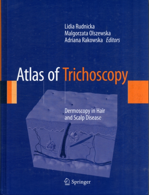 Atlas of Trichoscopy : Dermoscopy in Hair and Scalp Disease, Hardback Book