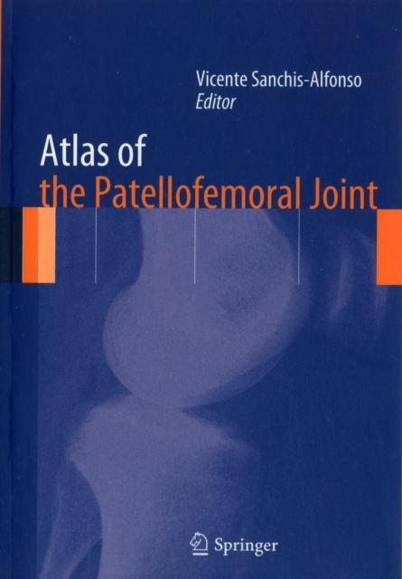 Atlas of the Patellofemoral Joint, Paperback / softback Book