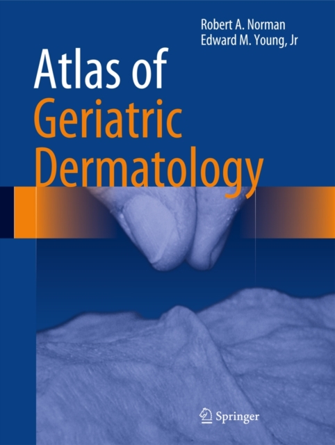 Atlas of Geriatric Dermatology, Hardback Book