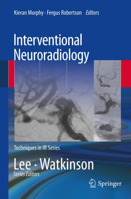 Interventional Neuroradiology, PDF eBook