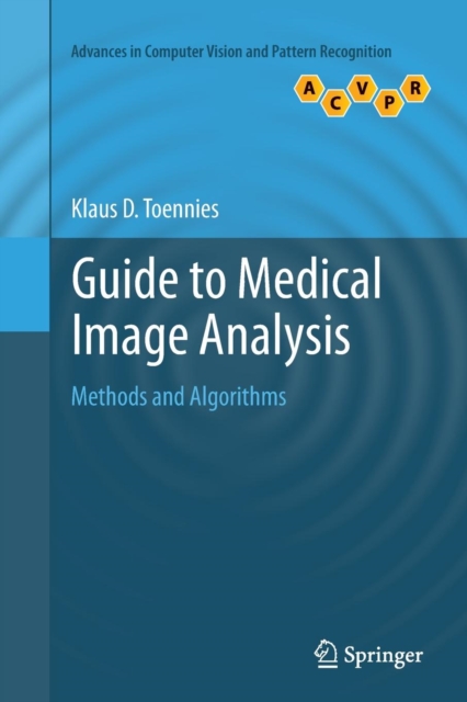 Guide to Medical Image Analysis : Methods and Algorithms, Paperback / softback Book