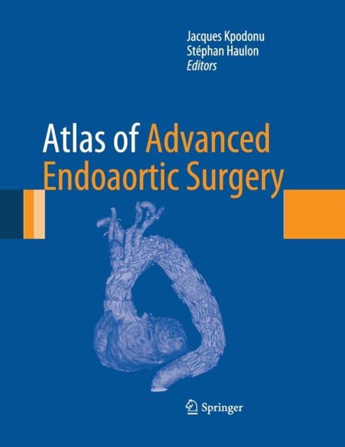 Atlas of Advanced Endoaortic Surgery, Paperback / softback Book