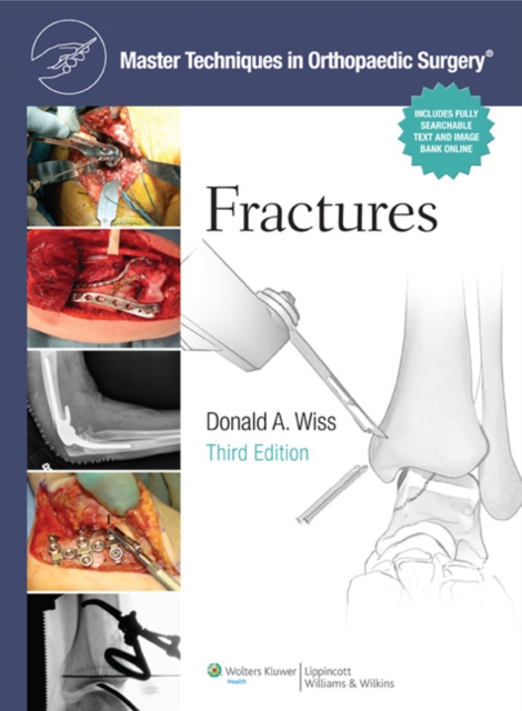 Master Techniques in Orthopaedic Surgery: Fractures, Hardback Book