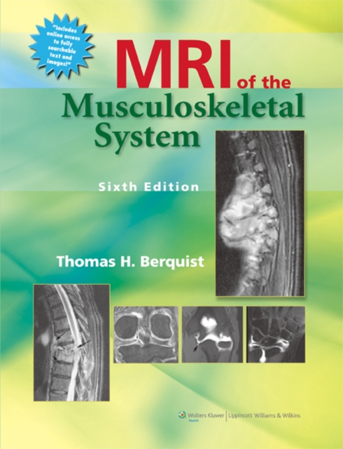 MRI of the Musculoskeletal System, Hardback Book