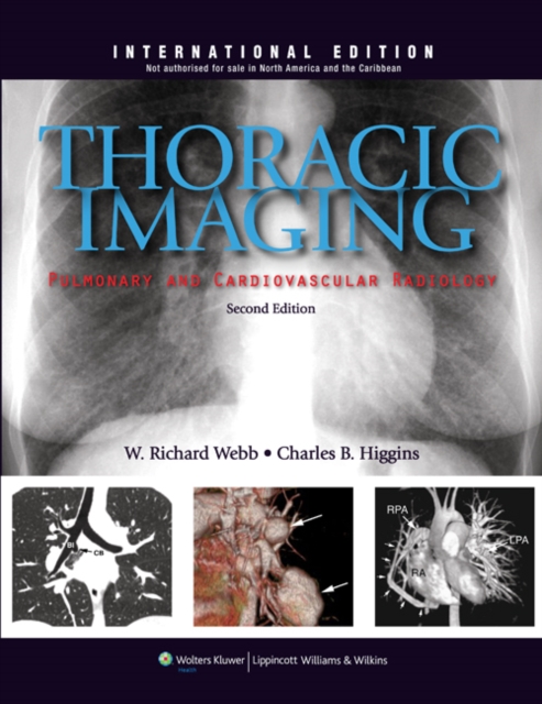 Thoracic Imaging: Pulmonary and Cardiovascular Radiology, Hardback Book