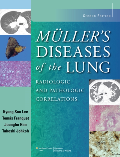 Muller's Diseases of the Lung : Radiologic and Pathologic Correlations, Hardback Book