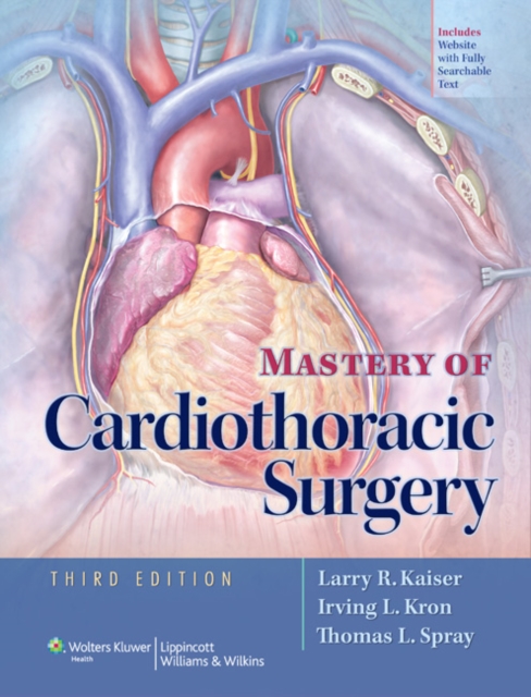 Mastery of Cardiothoracic Surgery, Hardback Book