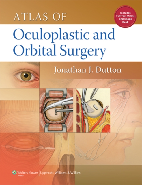 Atlas of Oculoplastic and Orbital Surgery, Hardback Book