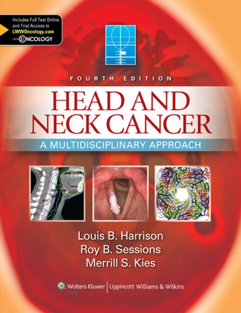 Head and Neck Cancer : A Multidisciplinary Approach, Hardback Book