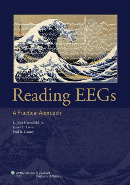 Reading EEGs: A Practical Approach, EPUB eBook