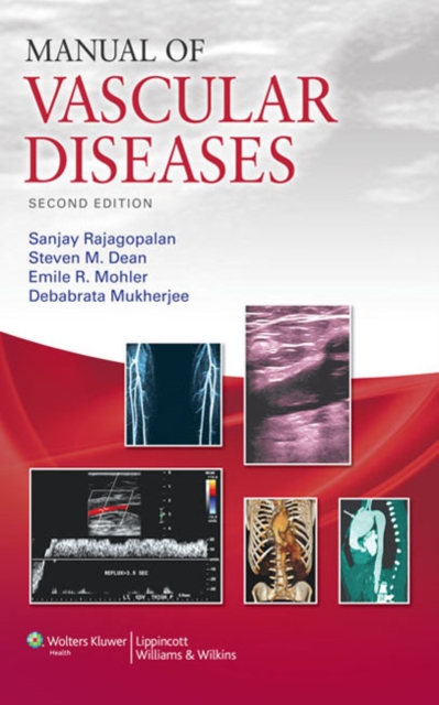 Manual of Vascular Diseases, EPUB eBook