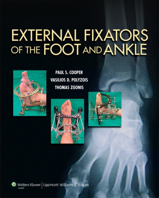 External Fixators of the Foot and Ankle, Hardback Book