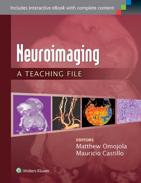 Neuroimaging: A Teaching File : A Teaching File, Paperback / softback Book
