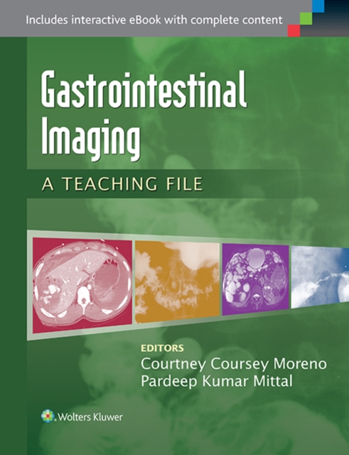 Gastrointestinal Imaging : A Teaching File, Paperback / softback Book
