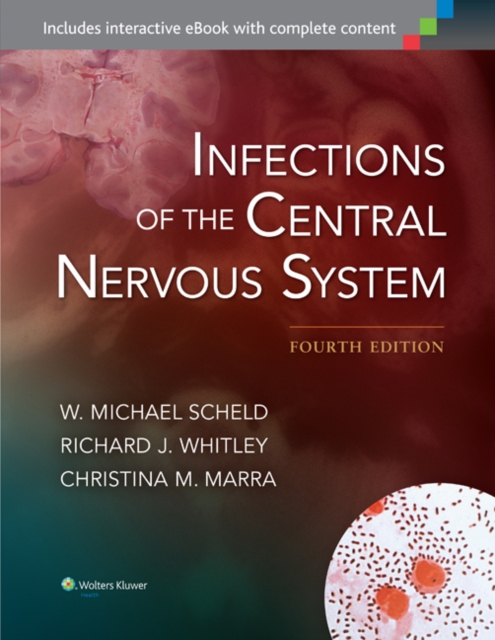 Infections of the Central Nervous System, Hardback Book