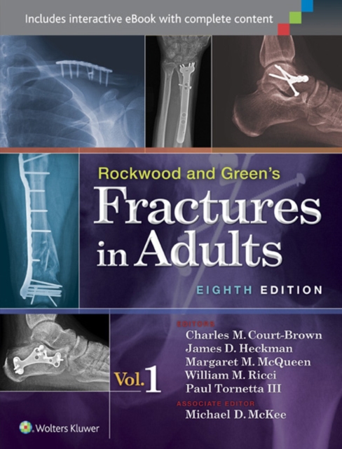 Rockwood and Green's Fractures in Adults, Multiple copy pack Book