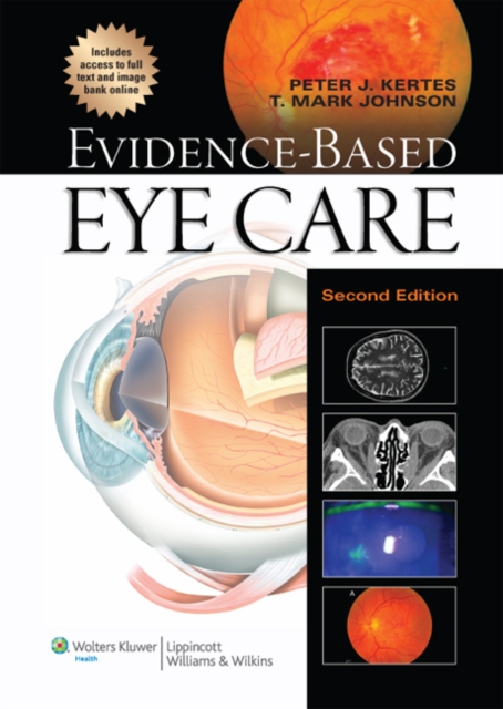 Evidence-Based Eye Care, Hardback Book