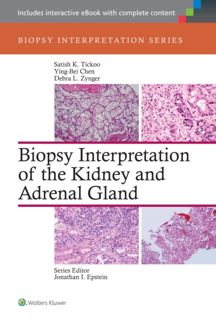 Biopsy Interpretation of the Kidney & Adrenal Gland, Hardback Book