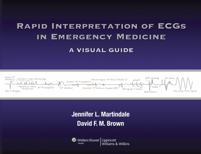 Rapid Interpretation of ECGs in Emergency Medicine : A Visual Guide, EPUB eBook