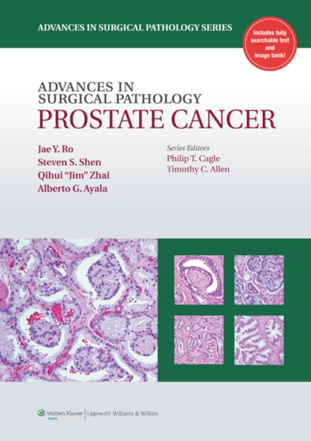 H27Advances in Surgical Pathology: Prostate Cancer, EPUB eBook