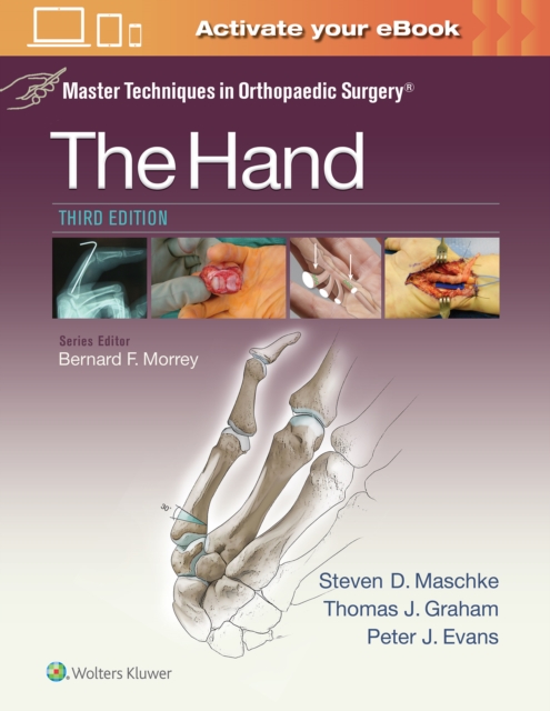 Master Techniques in Orthopaedic Surgery: The Hand, Hardback Book