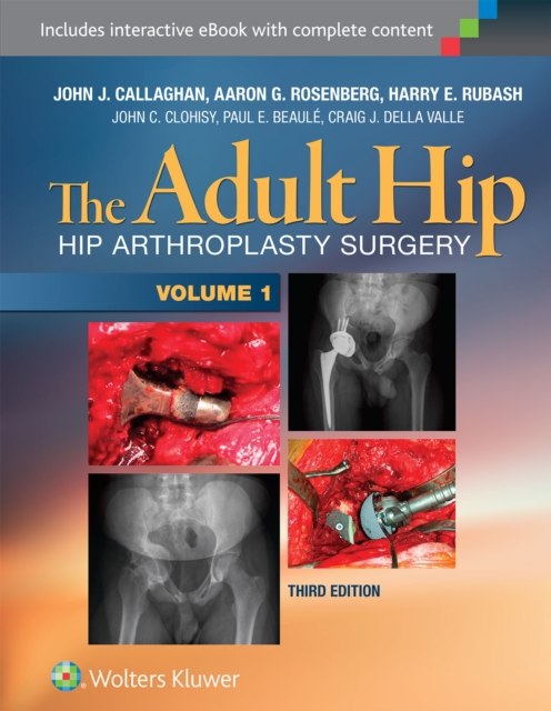 The Adult Hip (Two Volume Set) : Hip Arthroplasty Surgery, Multiple-component retail product Book
