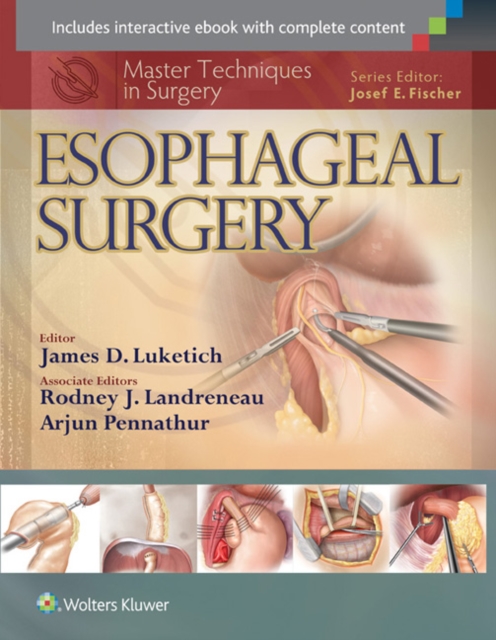 Master Techniques in Surgery: Esophageal Surgery, Hardback Book