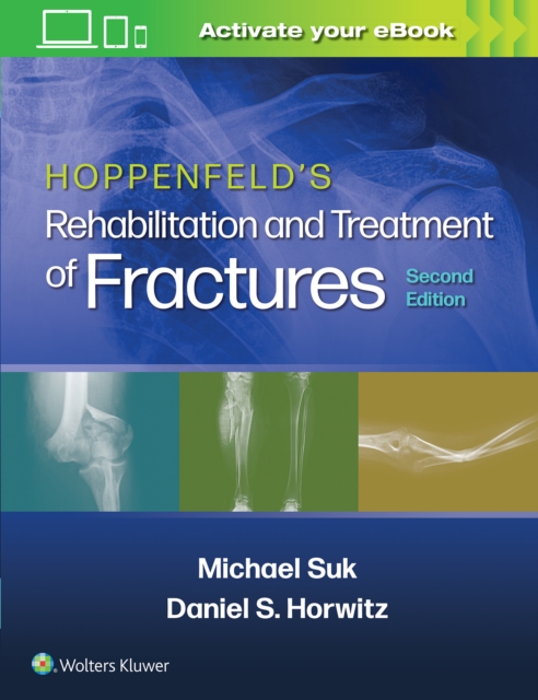 Hoppenfeld's Treatment and Rehabilitation of Fractures, Paperback / softback Book