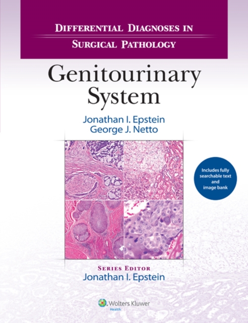 Differential Diagnoses in Surgical Pathology: Genitourinary System, Hardback Book