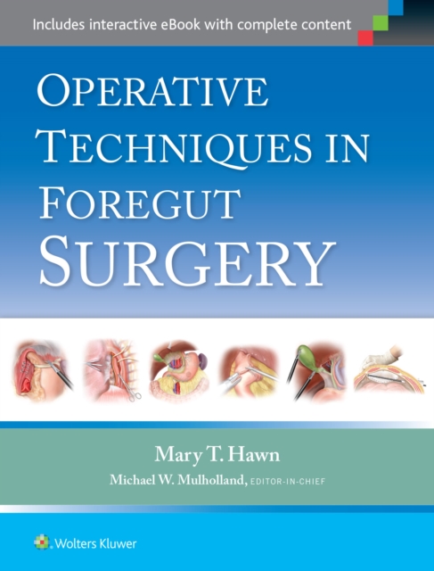 Operative Techniques in Foregut Surgery, Hardback Book