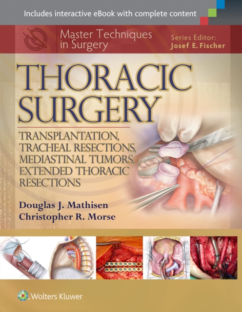 Master Techniques in Surgery: Thoracic Surgery: Transplantation, Tracheal Resections, Mediastinal Tumors, Extended Thoracic Resections, Hardback Book