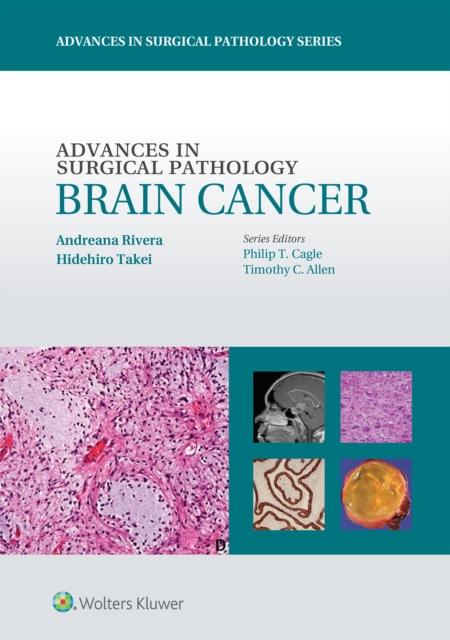Advances in Surgical Pathology: Brain Cancer, Hardback Book