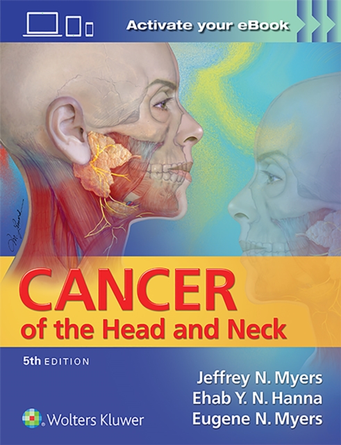 Cancer of the Head and Neck, Hardback Book